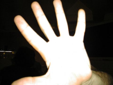 Paparazzi attack